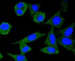 Ferritin Antibody in Immunocytochemistry (ICC/IF)