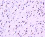 VAV2 Antibody in Immunohistochemistry (Paraffin) (IHC (P))