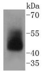 Adiponectin Receptor 1 Antibody in Western Blot (WB)