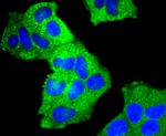 Cortactin Antibody in Immunocytochemistry (ICC/IF)