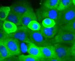 Cortactin Antibody in Immunocytochemistry (ICC/IF)