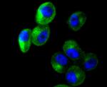 Cortactin Antibody in Immunocytochemistry (ICC/IF)