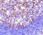 Cortactin Antibody in Immunohistochemistry (Paraffin) (IHC (P))