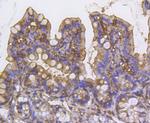 Cortactin Antibody in Immunohistochemistry (Paraffin) (IHC (P))