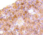 RALBP1 Antibody in Immunohistochemistry (Paraffin) (IHC (P))