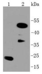 C/EBP beta Antibody in Western Blot (WB)