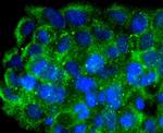 FNTB Antibody in Immunocytochemistry (ICC/IF)