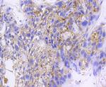 IkB beta Antibody in Immunohistochemistry (Paraffin) (IHC (P))