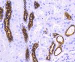 MUC1 Antibody in Immunohistochemistry (Paraffin) (IHC (P))