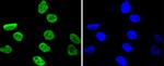 Phospho-MSK1 (Ser376) Antibody in Immunocytochemistry (ICC/IF)