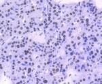 Phospho-STAT1 (Ser727) Antibody in Immunohistochemistry (Paraffin) (IHC (P))