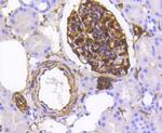 Nestin Antibody in Immunohistochemistry (Paraffin) (IHC (P))