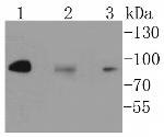 IKK alpha/beta Antibody in Western Blot (WB)