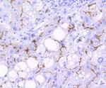 P-Glycoprotein Antibody in Immunohistochemistry (Paraffin) (IHC (P))