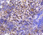 MMP11 Antibody in Immunohistochemistry (Paraffin) (IHC (P))