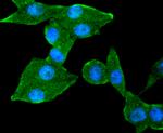 TACC3 Antibody in Immunocytochemistry (ICC/IF)