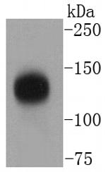 TACC3 Antibody in Western Blot (WB)