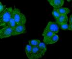 DJ-1 Antibody in Immunocytochemistry (ICC/IF)