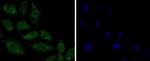 PP2A alpha/beta Antibody in Immunocytochemistry (ICC/IF)