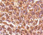 PP2A alpha/beta Antibody in Immunohistochemistry (Paraffin) (IHC (P))