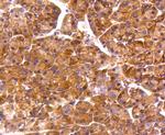 PP2A alpha/beta Antibody in Immunohistochemistry (Paraffin) (IHC (P))