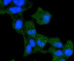 Cytokeratin 13 Antibody in Immunocytochemistry (ICC/IF)