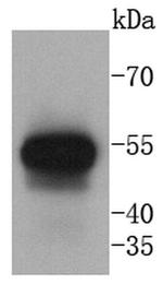 Cytokeratin 13 Antibody in Western Blot (WB)