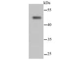 Cytokeratin 13 Antibody in Western Blot (WB)