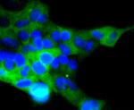 ACE2 Antibody in Immunocytochemistry (ICC/IF)