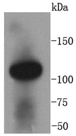 ACE2 Antibody in Western Blot (WB)