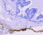 GYS1 Antibody in Immunohistochemistry (Paraffin) (IHC (P))