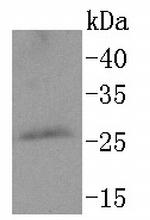 PPP1R1A Antibody in Western Blot (WB)