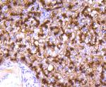 CD13 Antibody in Immunohistochemistry (Paraffin) (IHC (P))