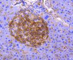 CD13 Antibody in Immunohistochemistry (Paraffin) (IHC (P))