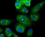 PYCARD Antibody in Immunocytochemistry (ICC/IF)