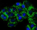 PYCARD Antibody in Immunocytochemistry (ICC/IF)