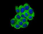 ABCF1 Antibody in Immunocytochemistry (ICC/IF)