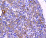 ABCF1 Antibody in Immunohistochemistry (Paraffin) (IHC (P))