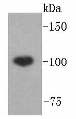 ABCF1 Antibody in Western Blot (WB)