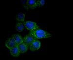 CPT2 Antibody in Immunocytochemistry (ICC/IF)