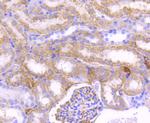 CPT2 Antibody in Immunohistochemistry (Paraffin) (IHC (P))