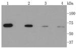 CPT2 Antibody in Western Blot (WB)