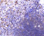 CD38 Antibody in Immunohistochemistry (Paraffin) (IHC (P))