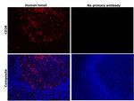 CD38 Antibody in Immunohistochemistry (Paraffin) (IHC (P))