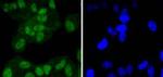 FANCD2 Antibody in Immunocytochemistry (ICC/IF)