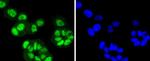 FANCD2 Antibody in Immunocytochemistry (ICC/IF)