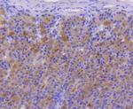 FANCD2 Antibody in Immunohistochemistry (Paraffin) (IHC (P))