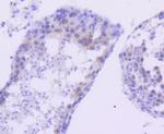 FANCD2 Antibody in Immunohistochemistry (Paraffin) (IHC (P))