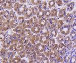 FANCD2 Antibody in Immunohistochemistry (Paraffin) (IHC (P))