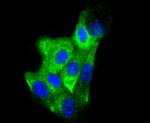 Cytokeratin 6 Antibody in Immunocytochemistry (ICC/IF)